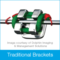 Traditional Damon Bracket