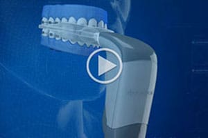 Acceledent Video at Drobocky Orthodontics in Bowling Green Glasgow Franklin KY